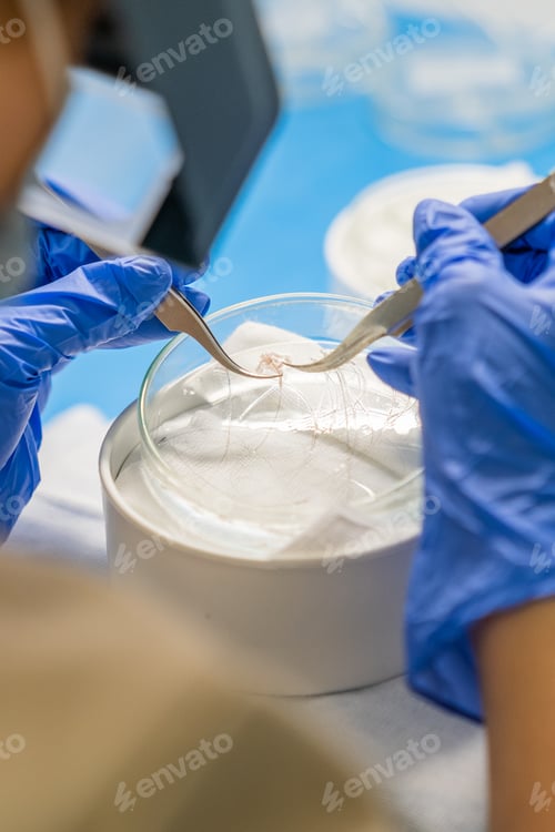 Preview: Surgeon performing the classification of follicular units with forceps for hair transplantation.