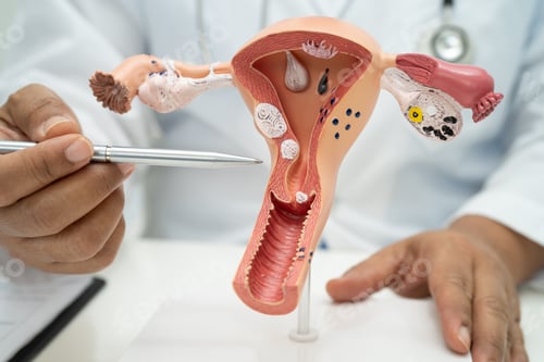 Preview: Uterus, doctor with anatomy model for study diagnosis and treatment in hospital.