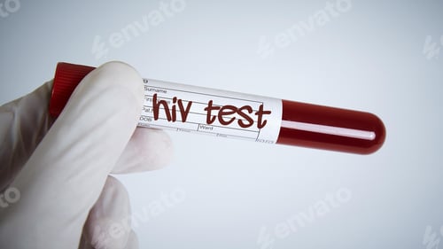 Preview: HIV virus, medical concept, Human Immunodeficiency Virus Positive test