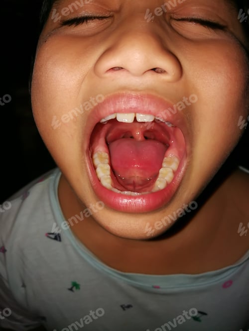 Preview: Young child showing sore throat to the doctor.