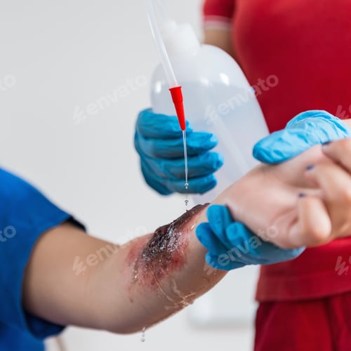 Preview: First Aid Training - Burn injury