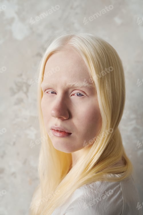 Preview: Young beautiful albino woman with no makeup looking at camera