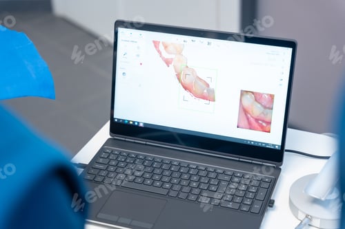 Preview: Dental clinic, dentist performing a 3d scan to the patient with the computer