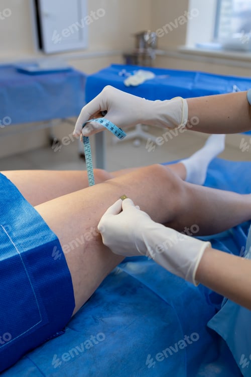 Preview: Medical professional measuring leg length and diameter for evaluation.
