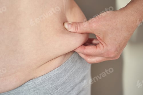 Preview: Caucasian adult pinching belly fat with fingers in close-up showing skin texture and body weight