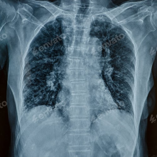 Preview: x-rays