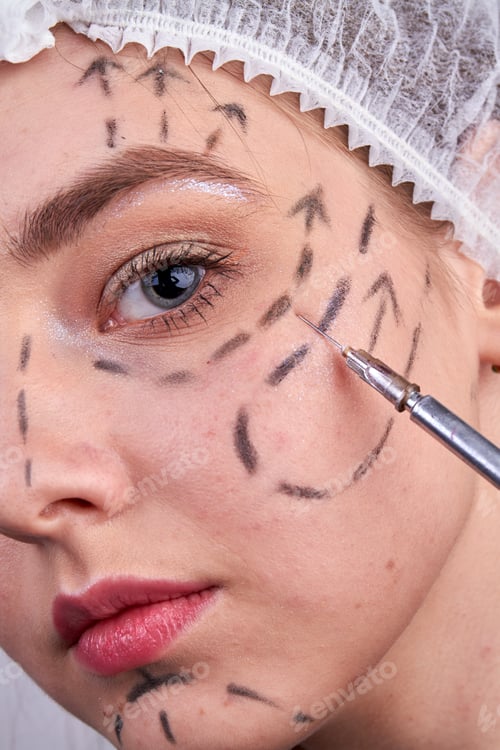 Preview: Close up cosmetic botox injection in young woman face.