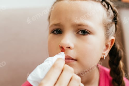 Preview: mom holding napkin near daughter with nasal bleeding