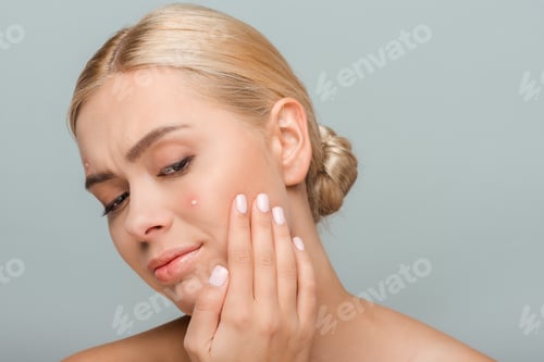 Preview: upset girl touching face with acne isolated on grey