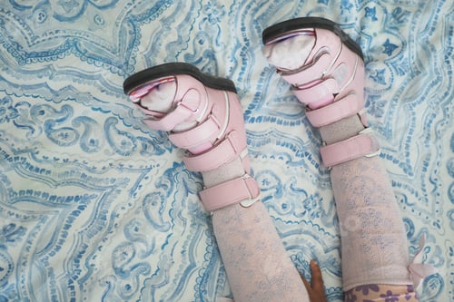 Preview: Child cerebral palsy disability, legs orthosis.