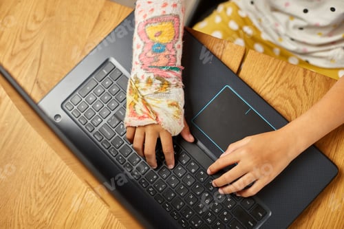 Preview: Teen girl with a broken arm orthopedic cast studying online