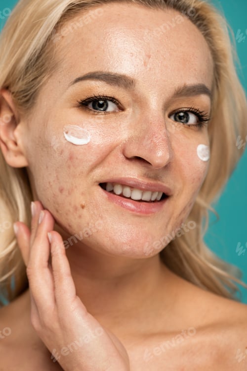 Preview: close up of cheerful woman with skin issues applying treatment cream on face isolated on turquoise
