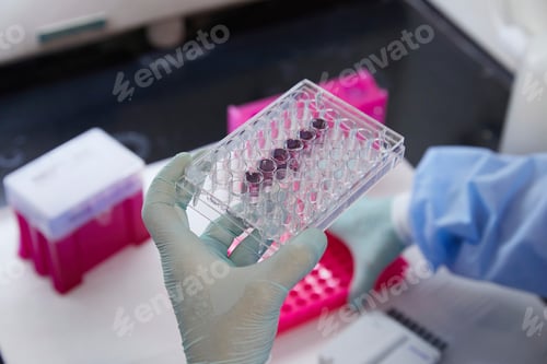 Preview: Tools and containers in a medical lab, work being done with pipette and samples