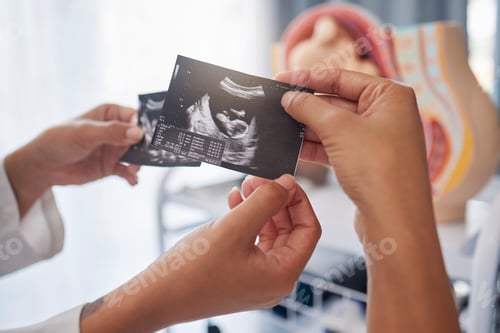 Preview: Sonogram, showing and hands with an ultrasound of a baby from the doctor to mother at a clinic. Con