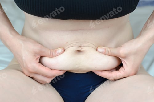 Preview: The woman shows excess belly fat. Fatty deposits on a woman's abdomen. Overweight, obesity concept