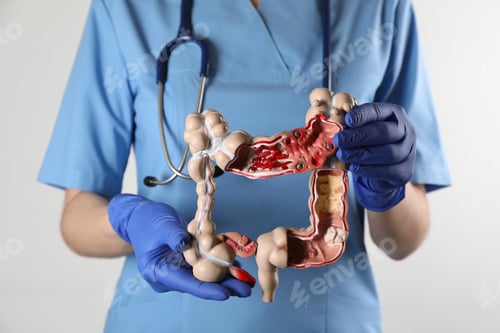 Preview: Gastroenterologist holding human colon model on white background, closeup