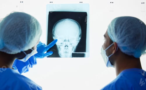 Preview: Doctors Examining Head X-Ray in Hospital Setting