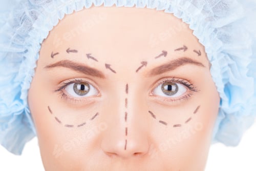 Preview: Waiting for plastic surgery.