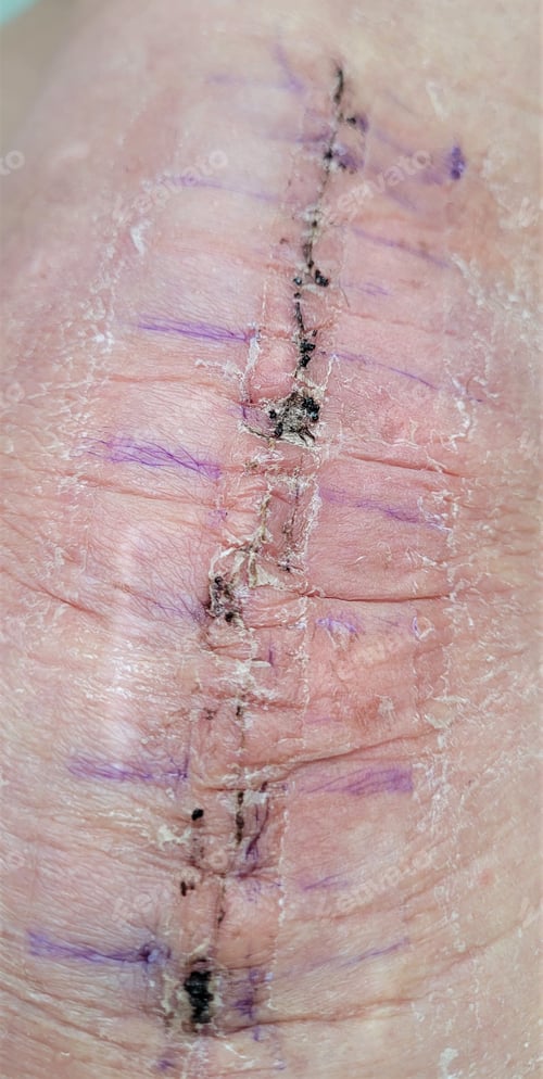 Preview: At the Doctor! Orthopedic Surgeon Exam! Post Knee Replacement Surgery!