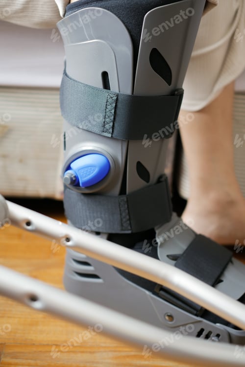 Preview: women broken feet with a grey plastic boot ankle brace injury protecting boot