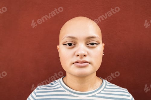 Preview: Young bald girl looking at camera outdoor - Focus on face