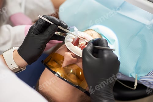Preview: Close-up view of a patient in a dental chair with a wide open mouth.