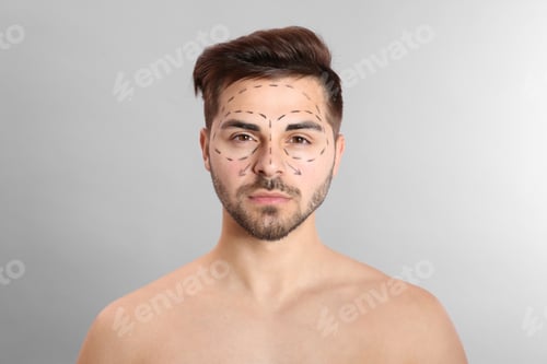 Preview: Young man with marks on face for cosmetic surgery operation against grey background