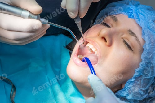 Preview: Dental team performs oral surgical procedure on female patient.