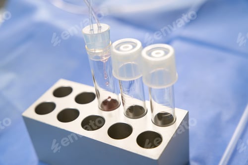 Preview: Close up of test tubes for eggcell retrieval or artificial insemination