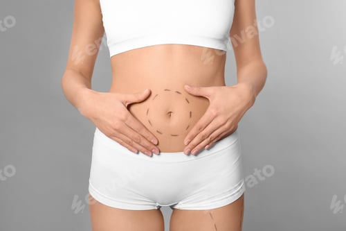 Vista previa: Young woman with marks on body for cosmetic surgery operation against grey background, closeup