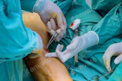 Preview: To treat injuries, doctors specializing in orthopedics perform surgeries on patient leg.