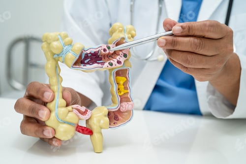 Preview: Intestine, appendix and digestive system, doctor holding anatomy model for study diagnosis