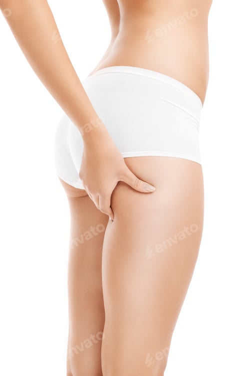Preview: Woman checking cellulite on her thigh