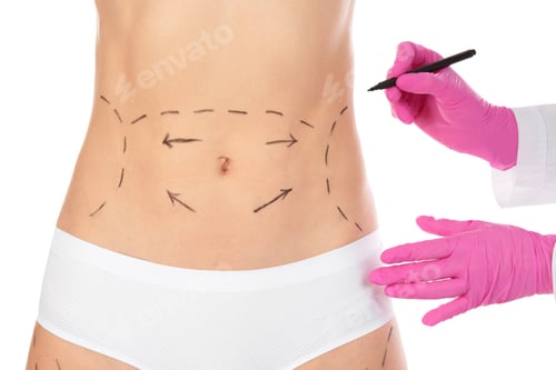 Preview: Doctor drawing marks on woman's body isolated on white. Cosmetic surgery