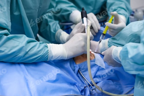 Preview: Surgeons Performing Procedure in Hospital Operating Room
