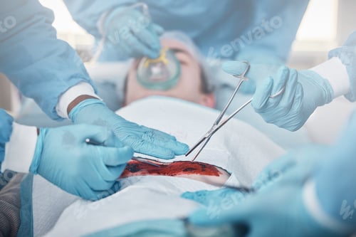 Preview: Surgeons Performing Invasive Procedure in Hospital Setting