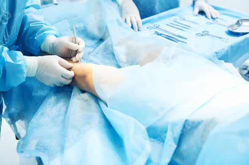 Preview: Professional surgeon making a cut of the skin