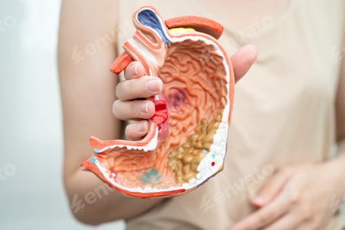 Preview: Stomach disease, Asian woman holding anatomy model for treatment in hospital.