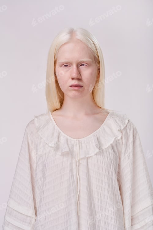 Preview: Young albino girl with white hair