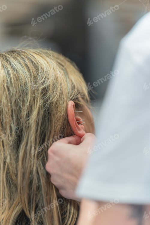 Preview: Elderly woman receiving acupuncture treatment on the ears