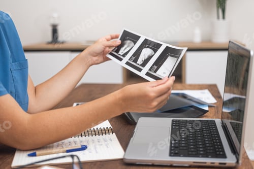 Preview: Female doctor holds images of ultrasound diagnostics reviewing results of patient examination