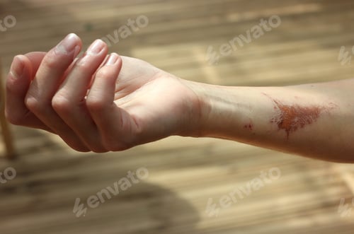 Preview: Woman's hand with scar