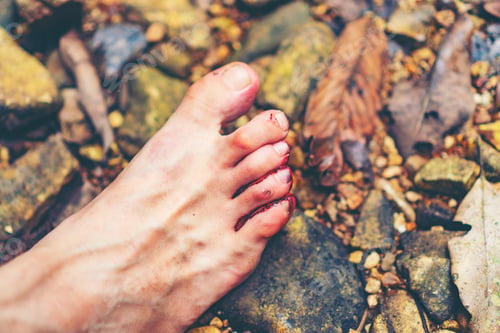 Preview: Blood flowing to the feet, From being bitten by leeches attack, Blood Sucking Leech