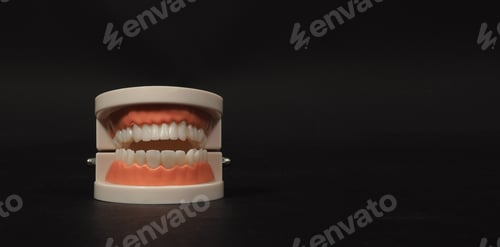 Preview: Orthodontic model of teeth isolated on black background.no people