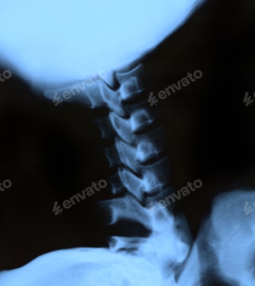Preview: x-ray of the neck
