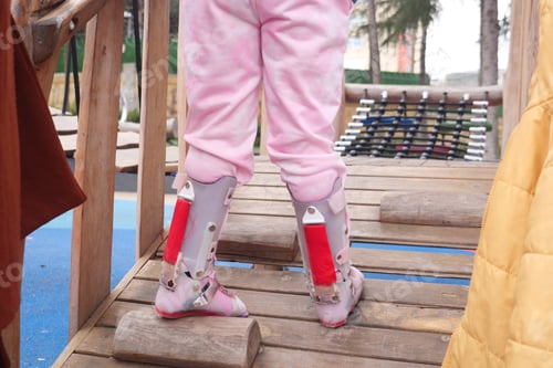 Preview: A little girl in orthosis shoes crosses a wooden bridge Child cerebral palsy disability.