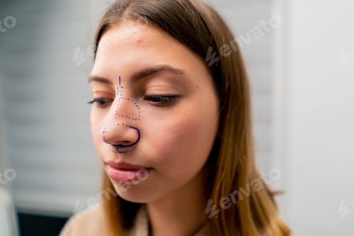Preview: close-up plastic surgeon makes marks on a patient's face during a consultation before nose operation