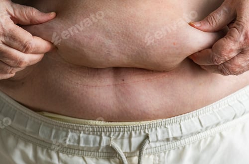 Preview: Closeup of obese elderly woman