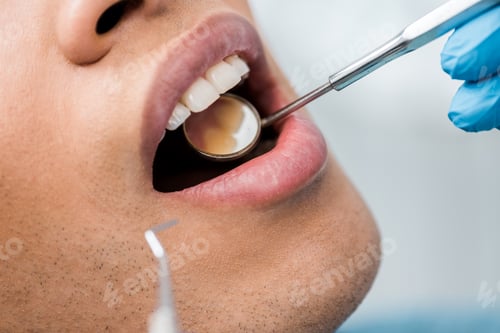 Preview: cropped view of african american man with medical instrument in open mouth