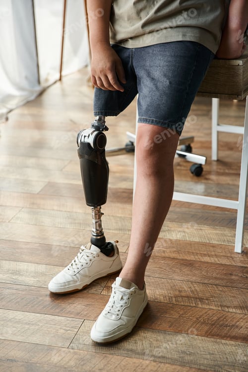 Preview: Young man showcases his stylish shorts and sneakers with a visible prosthetic leg